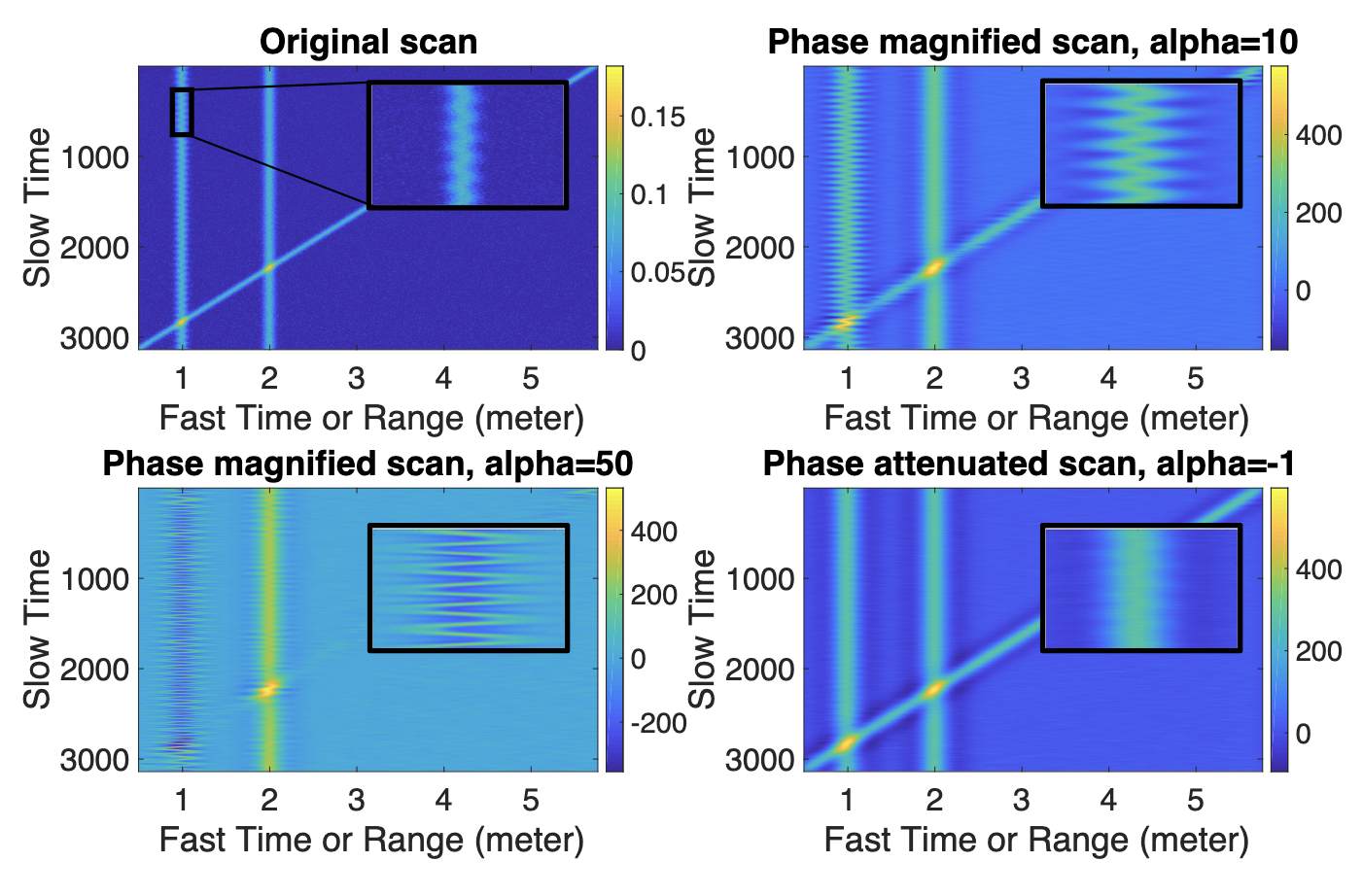 Eulerian Phase-based Motion Magnification for High-Fidelity Vital Sign Estimation with Radar in Clinical Settings